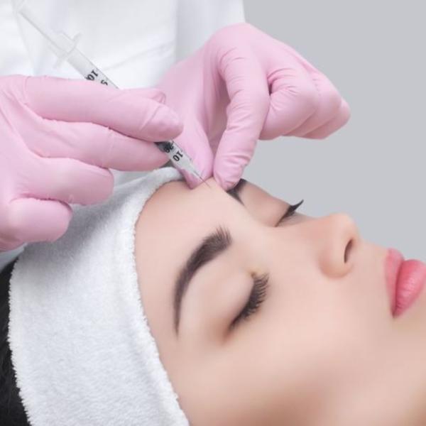 Trẻ hóa nâng cơ xía nhăn vùng trán 60 phút